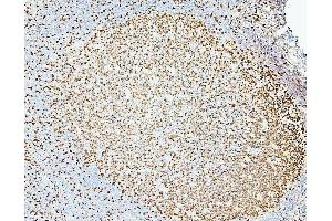 IHC analysis of MCM2 using anti-MCM2 antibody (ABIN7601593).