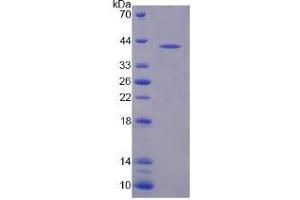 SDS-PAGE analysis of Human NAT8L Protein. (NAT8L Protein)