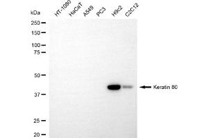 anti-Keratin 80 (KRT80) antibody