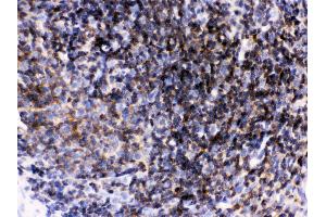 Immunohistochemistry (IHC) image for anti-Lymphocyte-Specific Protein tyrosine Kinase (LCK) (AA 468-506), (C-Term) antibody (ABIN3043870)