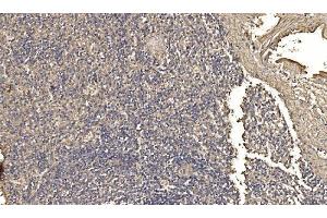 IHC analysis of ASK1/MAP3K5 using anti-ASK1/MAP3K5 antibody (ABIN7600304).