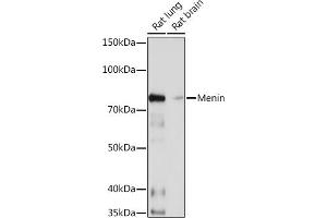 Western blot analysis of extracts of various cell lines, using Menin Rabbit mAb (ABIN7268697) at 1:1000 dilution. (Menin Antikörper)