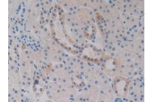 DAB staining on IHC-P; Samples: Rat Kidney Tissue (FCAR Antikörper  (AA 51-280))