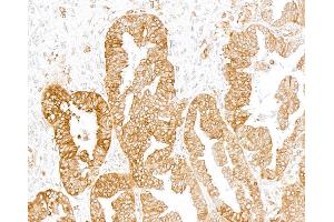 Immunohistochemistry (IHC) image for anti-Transmembrane Protein 173 (TMEM173) (C-Term) antibody (ABIN7795818) (Rekombinanter STING/TMEM173 Antikörper  (C-Term))