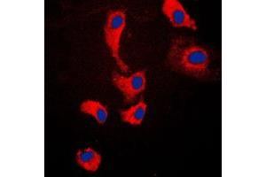 Immunofluorescent analysis of MYD88 staining in Jurkat cells. (MYD88 Antikörper  (Center))