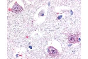 Anti-ROR Beta antibody IHC of human brain, thalamus. (RORB Antikörper  (Hinge Region))