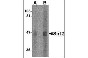 Western blot analysis of SIRT2 in human brain lysate with this product at (A) 2. (SIRT2 Antikörper  (N-Term))