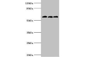 Western blot All lanes: 4-aminobutyrate aminotransferase, mitochondrial antibody at 10 μg/mL Lane 1: Rat liver tissue Lane 2: Mouse pancreatic tissue Lane 3: Mouse kidney tissue Secondary Goat polyclonal to rabbit IgG at 1/10000 dilution Predicted band size: 56 kDa Observed band size: 56 kDa (ABAT Antikörper  (AA 29-300))