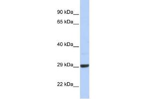 C10ORF56 antibody used at 1 ug/ml to detect target protein. (ZCCHC24 Antikörper  (Middle Region))