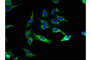 Immunofluorescent analysis of Hela cells using ABIN7146334 at dilution of 1:100 and Alexa Fluor 488-congugated AffiniPure Goat Anti-Rabbit IgG(H+L) (KCNMA1 Antikörper  (AA 1-86))