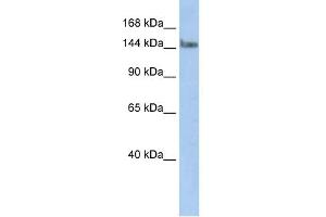 WB Suggested Anti-TCERG1 Antibody Titration:  0. (TCERG1 Antikörper  (N-Term))