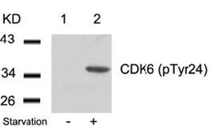 Image no. 2 for anti-Cyclin-Dependent Kinase 6 (CDK6) (pTyr24) antibody (ABIN319289) (CDK6 Antikörper  (pTyr24))