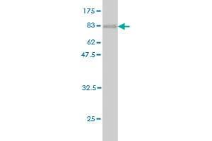 Western Blot detection against Immunogen (78. (AKT1 Antikörper  (AA 1-480))