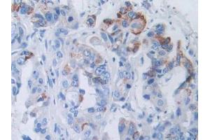 Used in DAB staining on fromalin fixed paraffin- embedded kidney tissue (SLC12A3 Antikörper  (AA 3-146))