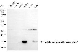 Western blotting analysis using cellular retinoic acid binding protein 1 antibody (ABIN7798021). (Rekombinanter CRABP1 Antikörper)