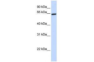 WB Suggested Anti-ZNF280B Antibody Titration:  0. (ZNF280B Antikörper  (C-Term))