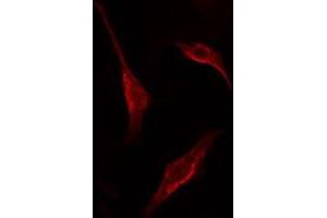 ABIN6275361 staining HT29 cells by IF/ICC. (PNN Antikörper  (Internal Region))