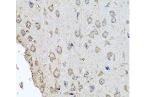 Immunohistochemistry of paraffin-embedded Mouse brain using HBA2 Polyclonal Antibody at dilution of 1:100 (40x lens). (HBa2 Antikörper)