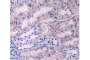 IHC-P analysis of Human Kidney Tissue, with DAB staining. (IL-2 Antikörper  (AA 21-153))