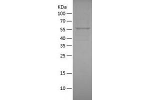 Western Blotting (WB) image for Phosphoglucomutase 1 (PGM1) (AA 1-562) protein (His tag) (ABIN7124410) (Phosphoglucomutase 1 Protein (PGM1) (AA 1-562) (His tag))