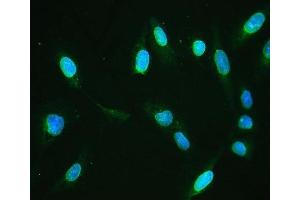 IF analysis of Emerin using anti-Emerin antibody (ABIN4886569). (Emerin Antikörper  (N-Term))