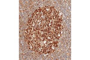 Immunohistochemical analysis of paraffin-embedded human tonsil tissue using (ABIN1882267 and ABIN2838476) performed on the Leica® BOND RXm.