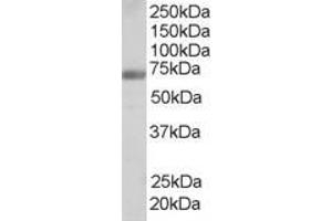 Western Blotting (WB) image for anti-Formin Binding Protein 1 (FNBP1) (Internal Region) antibody (ABIN2465683)