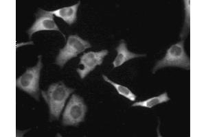 Immunofluorescent staining of A549 (ATCC CCL-185) cells. (CAMP-Dependent Protein Kinase R1 (PKA-R1) (AA 225-381) Antikörper)