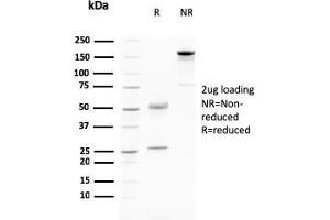SDS-PAGE Analysis Purified Desmoglein-3 Mouse Monoclonal Antibody (DSG3/2796). (Desmoglein 3 Antikörper  (AA 379-491))