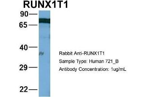 Western Blotting (WB) image for anti-Runt-Related Transcription Factor 1, Translocated To, 1 (Cyclin D-Related) (RUNX1T1) (Middle Region) antibody (ABIN1108915)