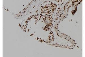 ABIN6263166 and ABIN6276979 at 1/100 staining Rat lung tissue by IHC-P. (MCM6 Antikörper  (C-Term))