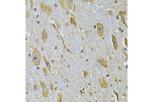 Immunohistochemistry of paraffin-embedded mouse brain using ITGA2 Antibody. (ITGA2 Antikörper)