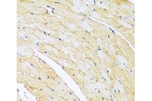 Immunohistochemistry of paraffin-embedded Mouse heart using ARL4A Polyclonal Antibody at dilution of 1:100 (40x lens). (ARL4A Antikörper)