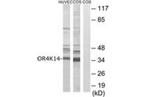 Western blot analysis of extracts from COS7/HuvEc cells, using OR4K14 Antibody. (OR4K14 Antikörper  (AA 261-310))