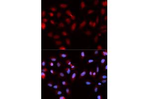 Immunofluorescence analysis of U2OS cells using BIRC5 antibody. (Survivin Antikörper  (AA 1-142))