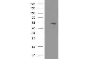 Western Blotting (WB) image for anti-Amyloid beta (A4) Precursor Protein-Binding, Family B, Member 3 (APBB3) antibody (ABIN1496654) (APBB3 Antikörper)