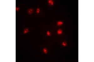 Immunofluorescence (IF) image for anti-SWI/SNF Related, Matrix Associated, Actin Dependent Regulator of Chromatin, Subfamily E, Member 1 (SMARCE1) antibody (ABIN7308352)