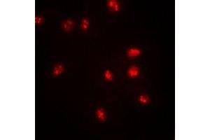 Immunofluorescent analysis of BAF57 staining in SW620 cells. (SMARCE1 Antikörper)