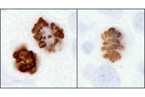 Immunohistochemistry (IHC) image for anti-Histone H3 (H3) (pSer10) antibody (ABIN7449558) (Histone 3 Antikörper  (pSer10))