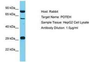 Image no. 1 for anti-POTE Ankyrin Domain Family, Member H (POTEH) (AA 421-470) antibody (ABIN6750592) (POTEH Antikörper  (AA 421-470))