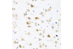 Immunohistochemistry of paraffin-embedded mouse brain using C8orf4 antibody (ABIN5975014) at dilution of 1/100 (40x lens). (C8orf4 Antikörper)