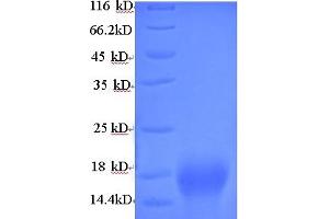 SDS-PAGE (SDS) image for Pvt-Associated Transcript (PAT) (AA 1-183), (full length) protein (His tag) (ABIN5714048) (Pvt-Associated Transcript Protein (PAT) (AA 1-183, full length) (His tag))