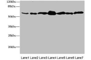 Western blot All lanes: NAE1 antibody at 1. (NAE1 Antikörper  (Regulatory Subunit))