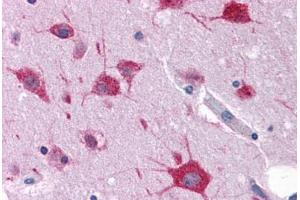 Human Brain, Cortex: Formalin-Fixed, Paraffin-Embedded (FFPE) (FAM59A Antikörper  (C-Term))