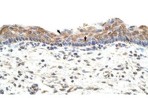 GNB1L antibody was used for immunohistochemistry at a concentration of 4-8 ug/ml to stain Squamous epithelial cells (arrows) in Human Skin. (GNB1L Antikörper)
