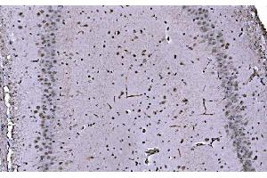 IHC analysis of CBX1/HP1 beta using anti-CBX1/HP1 beta antibody (ABIN7602012). (CBX1 Antikörper  (AA 55-185))