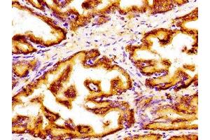 Immunohistochemistry of paraffin-embedded human prostate tissue using ABIN7154296 at dilution of 1:100 (GOLPH3 Antikörper  (AA 16-150))