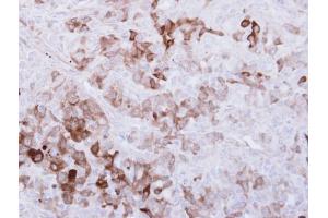 IHC-P Image Immunohistochemical analysis of paraffin-embedded DU-145 xenograft, using ALDH1A1, antibody at 1:500 dilution. (ALDH1A1 Antikörper  (C-Term))