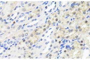 Immunohistochemistry of paraffin-embedded Mouse kidney using TRIM27 Polyclonal Antibody at dilution of 1:100 (40x lens). (TRIM27 Antikörper)