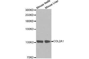 Western blot analysis of extracts of various cell lines, using COL2A1 antibody. (COL2A1 Antikörper  (AA 873-1072))